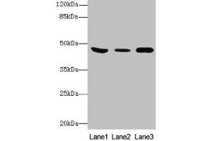 Western Blot All lanes: B4GALT5 antibody at 8 μg/mL Lane 1: Mouse heart tissue Lane 2: Mouse liver tissue Lane 3: Mouse brain tissue Secondary Goat polyclonal to rabbit IgG at 1/10000 dilution Predicted band size: 46 kDa Observed band size: 46 kDa