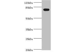 Western blot, All lanes: BACH1 antibody at 2ug/ml + Mouse thymus tissue. (BACH1 anticorps  (AA 1-320))