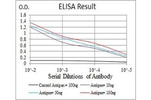 Black line: Control Antigen (100 ng), Purple line: Antigen(10 ng), Blue line: Antigen (50 ng), Red line: Antigen (100 ng), (L-Selectin anticorps  (AA 83-186))