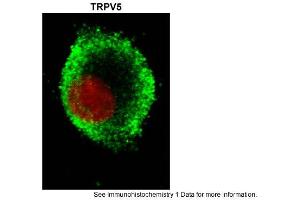Sample Type: hRetinal pigment epithelial cellsGreen: primaryRed: nuclearPrimary Dilution: 1:200Secondary Antibody: goat anti-rabbit-Alexa 488Secondary Dilution: 1:500Image Submitted by: Brian KennedyIndiana University Northwest . (TRPV5 anticorps  (N-Term))