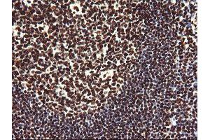 anti-Non-POU Domain Containing, Octamer-Binding (NONO) (AA 184-385) antibody