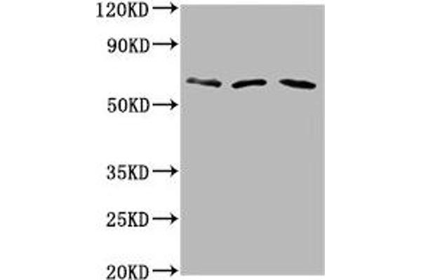 PHACTR1 anticorps  (AA 263-387)