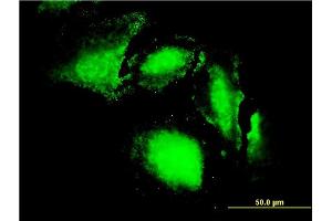 Immunofluorescence of monoclonal antibody to ERN1 on HeLa cell. (ERN1 anticorps  (AA 401-500))