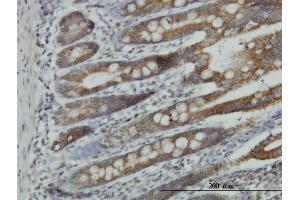 Immunoperoxidase of monoclonal antibody to NDUFA9 on formalin-fixed paraffin-embedded human small Intestine.