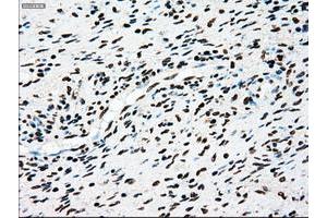 Image no. 8 for anti-TYRO3 Protein Tyrosine Kinase (TYRO3) antibody (ABIN1501605)