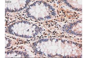 Image no. 5 for anti-Myc Proto-Oncogene protein (MYC) antibody (ABIN1497012) (c-MYC anticorps)