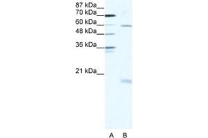 WB Suggested Anti-SOX9 Antibody Titration:  2. (SOX9 anticorps  (N-Term))