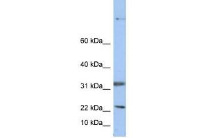 Selenoprotein antibody used at 1 ug/ml to detect target protein.