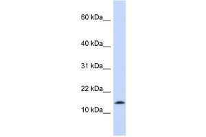 Synuclein Alpha antibody used at 1 ug/ml to detect target protein. (SNCA anticorps)