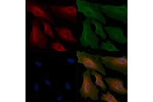ABIN6264894 and ABIN6266632 staining  cells by IF/ICC. (S100A1 anticorps  (N-Term))