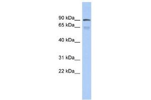 WB Suggested Anti-ZNF791 Antibody Titration:  0. (ZNF791 anticorps  (Middle Region))
