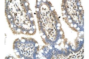 Complement C8b antibody was used for immunohistochemistry at a concentration of 4-8 ug/ml to stain EpitheliaI cells of intestinal villus (arrows) in Human Intestine. (C8B anticorps  (Middle Region))