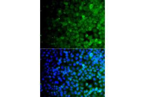 Immunofluorescence analysis of A549 cells using USP10 antibody (ABIN4905568). (USP10 anticorps)