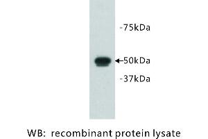 Image no. 1 for anti-FAT Tumor Suppressor Homolog 1 (FAT1) antibody (ABIN1112925) (FAT1 anticorps)