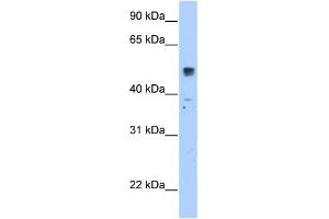 WB Suggested Anti-SLC35F5 Antibody Titration:  2. (SLC35F5 anticorps  (C-Term))