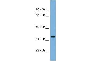 WB Suggested Anti-PEX11A Antibody Titration:  0. (PEX11A anticorps  (N-Term))