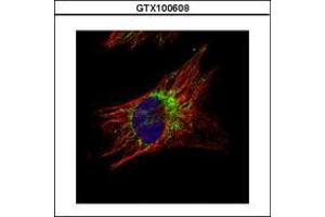 Image no. 3 for anti-DnaJ (Hsp40) Homolog, Subfamily A, Member 3 (DNAJA3) (AA 1-446) antibody (ABIN1497866)