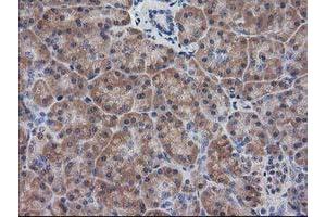 Image no. 7 for anti-Destrin (Actin Depolymerizing Factor) (DSTN) antibody (ABIN1497908)