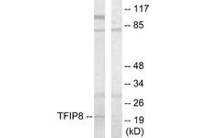 Western blot analysis of extracts from HuvEc cells, using TFIP8 Antibody. (Cytokeratin 5 anticorps  (AA 31-80))
