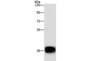 Western Blot analysis of Mouse heart tissue using CEBP epsilon Polyclonal Antibody at dilution of 1:500 (CEBPE anticorps)