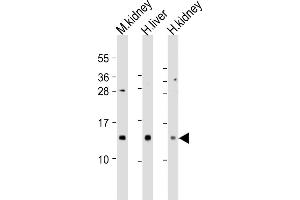 All lanes : Anti-MTCP1 Antibody (C-Term) at 1:2000 dilution Lane 1: mouse kidney lysates Lane 2: human liver lysates Lane 3: human kidney lysates Lysates/proteins at 20 μg per lane.