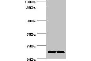 Western blot All lanes: CMPK1 antibody at 3. (Cytidine Monophosphate (UMP-CMP) Kinase 1, Cytosolic (CMPK1) (AA 37-196) anticorps)