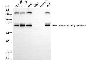 Western blotting analysis using SUMO specific peptidase 1 antibody (ABIN7800975). (Recombinant SUMO Specific Peptidase 1 anticorps)
