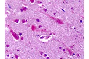 Anti-GRM7 / MGLUR7 antibody IHC of human brain, cortex.