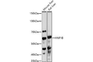 Western blot analysis of extracts of various cell lines, using HNF1B antibody (ABIN3017358, ABIN3017359, ABIN3017360, ABIN1680315 and ABIN1680316) at 1:1000 dilution. (HNF1B anticorps  (AA 100-200))