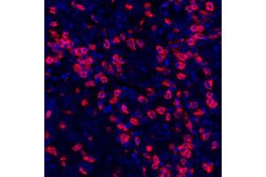 Immunofluorescence (IF) image for anti-CD8a Molecule (CD8A) (AA 185-235) antibody (ABIN7449561)