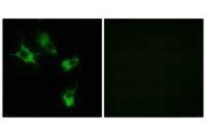 Immunofluorescence analysis of COS-7 cells, using MAST4 antibody. (MAST4 anticorps)