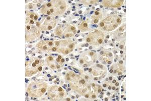 Immunohistochemistry of paraffin-embedded mouse kidney using ID3 antibody (ABIN5973111) at dilution of 1/200 (40x lens). (ID3 anticorps)
