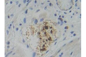 Detection of PFKP in Human Stomach Tissue using Polyclonal Antibody to Phosphofructokinase, Platelet (PFKP)