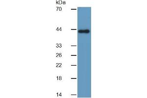 Rabbit Detection antibody from the kit in WB with Positive Control: Sample Human heart lysate.