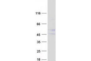Validation with Western Blot
