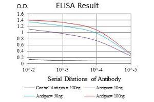 Black line: Control Antigen (100 ng), Purple line: Antigen(10 ng), Blue line: Antigen (50 ng), Red line: Antigen (100 ng),