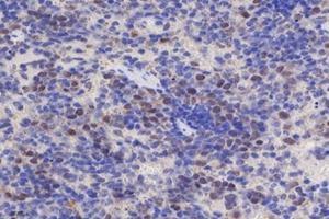 Immunohistochemistry analysis of paraffin-embedded mouse spleen using,EDD (ABIN7076102) at dilution of 1: 700 (UBR5 anticorps)