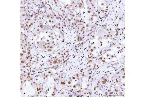 IHC analysis of ARID1A using anti-ARID1A antibody (ABIN7602567). (ARID1A anticorps  (AA 857-1552))