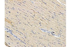ABIN7096452 and ABIN7100516 at 1/100 staining rat muscle tissue by IHC-P. (GFPT2 anticorps)