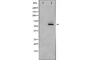 Western blot analysis of Akt2 expression in TNF-α treated A2780 whole cell lysates,The lane on the left is treated with the antigen-specific peptide. (AKT2 anticorps  (C-Term))