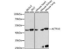 Western blot analysis of extracts of various cell lines, using  antibody (ABIN7265390) at 1:1000 dilution. (ACTR10 anticorps  (AA 218-417))