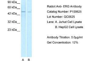 WB Suggested Anti-ERG  Antibody Titration: 1. (ERG anticorps  (Middle Region))