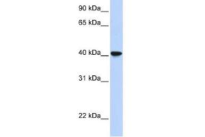 WB Suggested Anti-SIGLEC6 Antibody Titration:  0. (SIGLEC6 anticorps  (Middle Region))