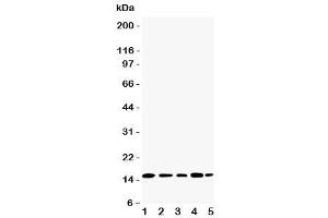Western blot testing of TIA-1 antibody and Lane 1:  Jurkat (TIA1 anticorps  (N-Term))