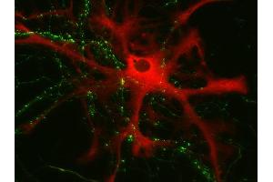 Immunocytochemistry (ICC) image for anti-phosphorylase, Glycogen, Brain (GPBB) (AA 826-842) antibody (ABIN1742514)