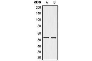 Western blot analysis of p53 (pS15) expression in HeLa UV-treated (A), PC12 (B) whole cell lysates. (p53 anticorps  (N-Term, pSer15))