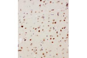 Anti-MEKK3 antibody, IHC(P) IHC(P): Rat Brain Tissue