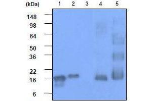 Western Blotting (WB) image for anti-Synuclein, alpha (SNCA) (AA 119-140) antibody (ABIN317563) (SNCA anticorps  (AA 119-140))