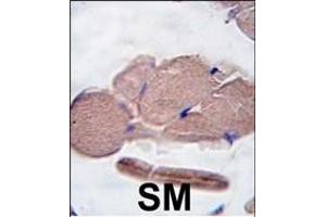 Formalin-fixed and paraffin-embedded human skeletal muscle tissue reacted with GDF8 antibody (N-term ) (ABIN388821 and ABIN2839139) , which was peroxidase-conjugated to the secondary antibody, followed by DAB staining.