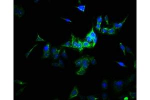 Immunofluorescence staining of HepG2 cells with ABIN7170953 at 1:166, counter-stained with DAPI. (SULT1A3 anticorps  (AA 1-295))